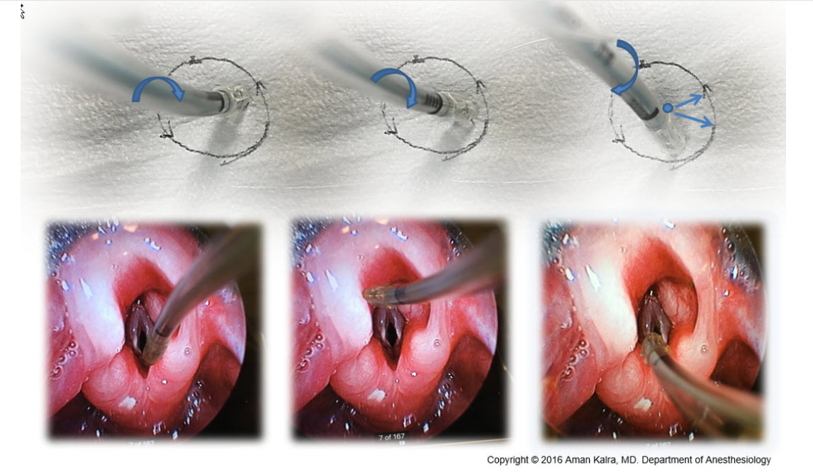 Intubation Positioning 2