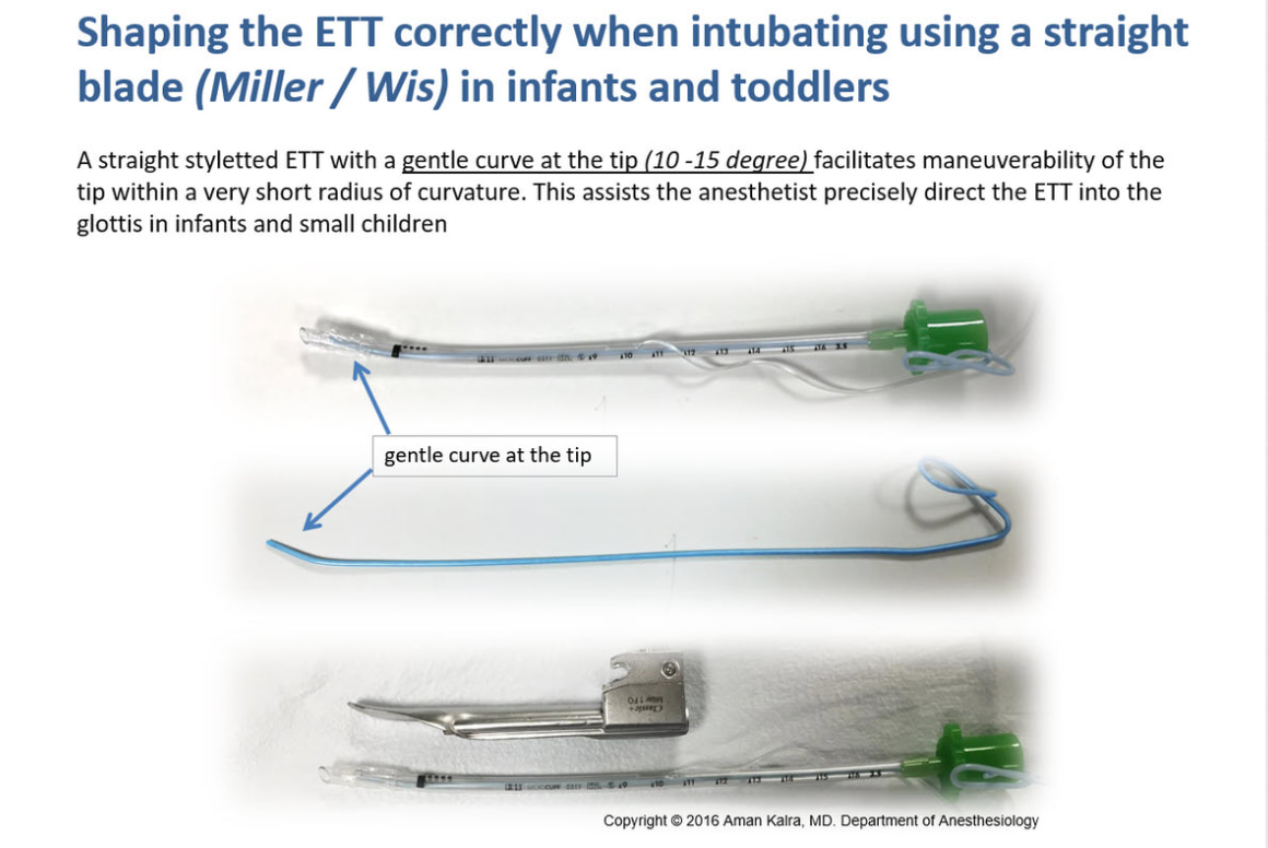 Intubation Positioning