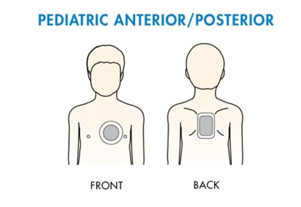 Pediatric Anterior/Posterior